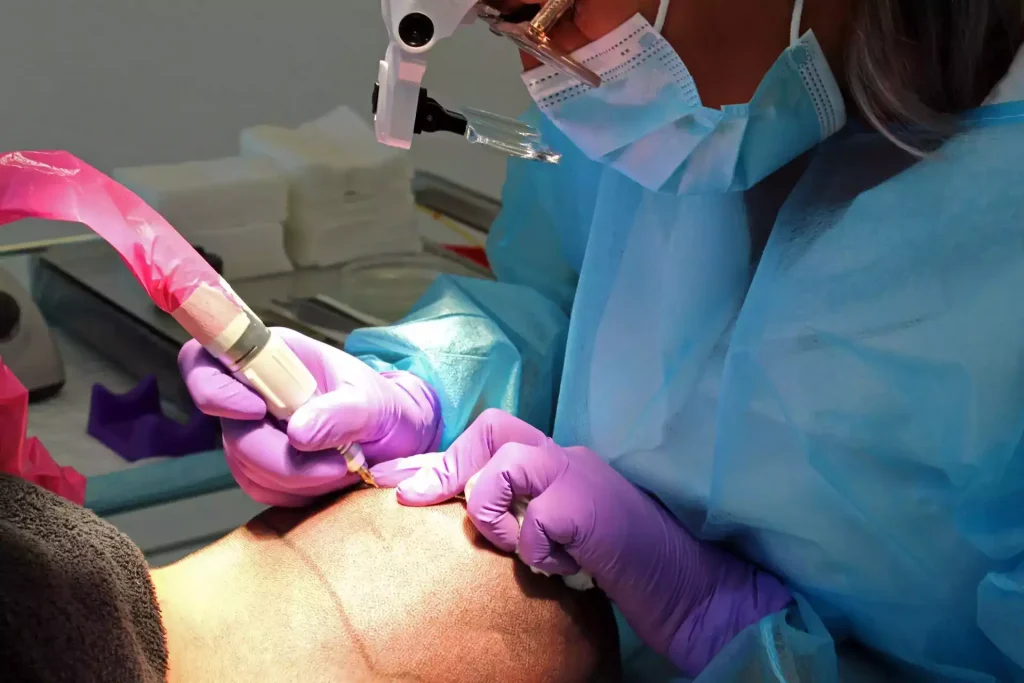 Wordt een haartransplantatie vergoed en is deze aftrekbaar van de belasting?