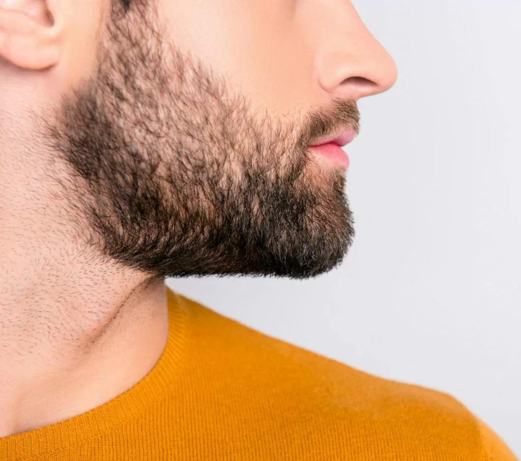 snortransplantatie baardtransplantatie